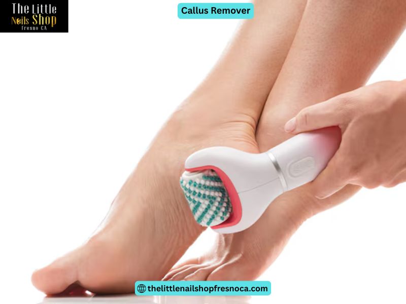 Callus Remover