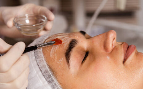 Chemical Peels in Islamabad